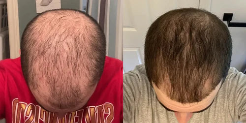 <h2>Loved by everyone, everywhere. Don't miss out.</h2>