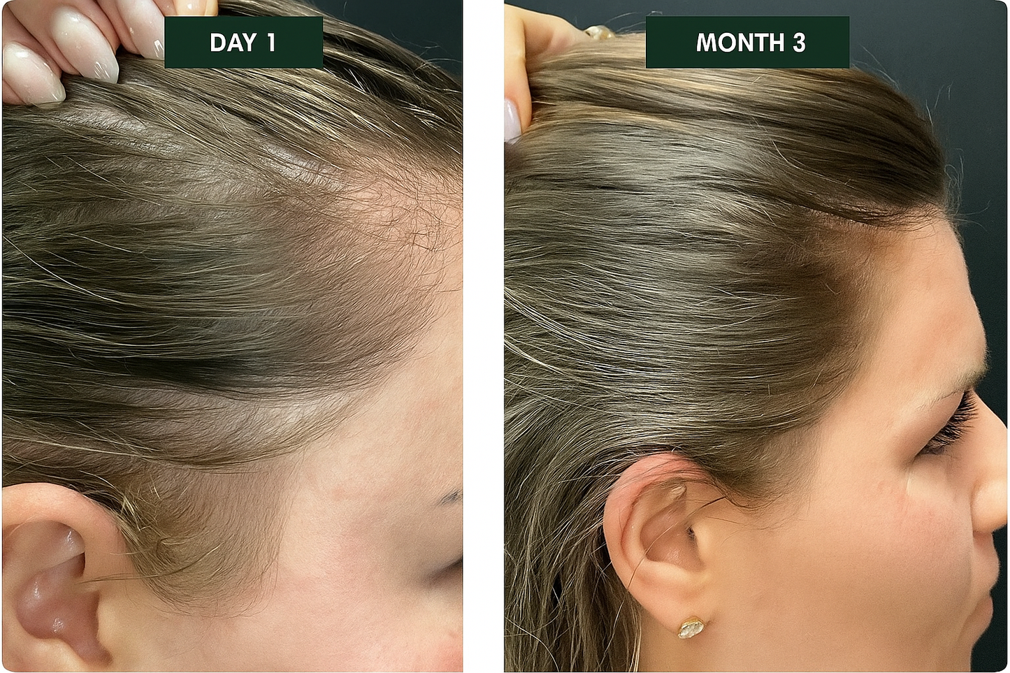 Revora™ – Scalp Therapy Shampoo Bar
