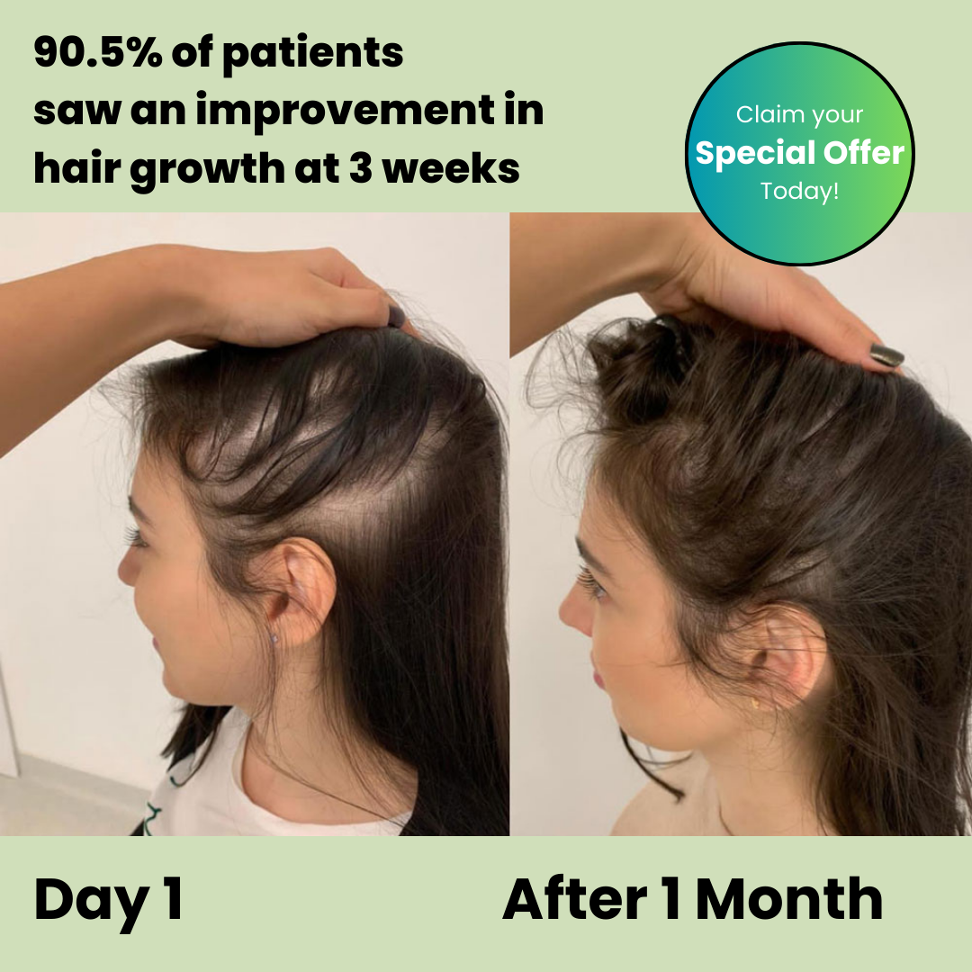 Revora™ – Scalp Therapy Shampoo Bar