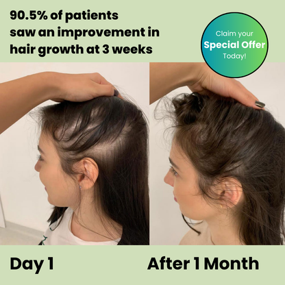 Revora™ – Scalp Therapy Shampoo Bar